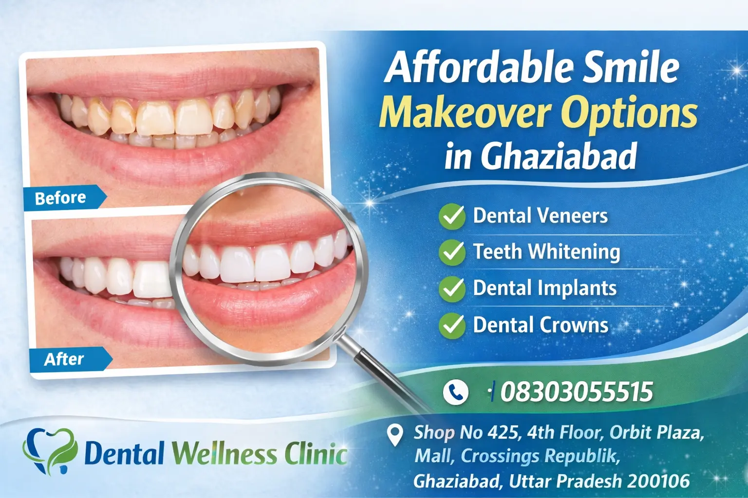 Affordable Smile Makeover Options in Ghaziabad